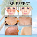 Gel Solar Aquoso com Ácido Hialurônico Isntree