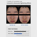 Medicube ZERO PORE PAD 2.0Pore Cleansing,Hydrating&Soothing,Oily/Combination Skin Care,K-Beauty,Korean Makeup